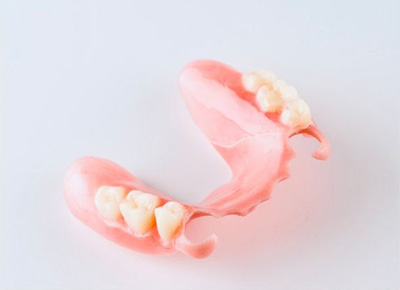 ノンクラスプデンチャー